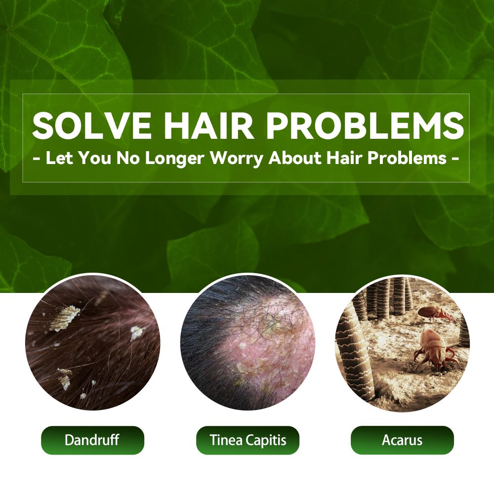 Anti-Dandruff Shampoo,Shampoo For Scalp Prone To Folliculitis, Dermatitis, Dandruff, Itchy And Flaky Scalp,Treats Dandruff And Seborrheic Dermatitis,Anti-Itch Shampoo