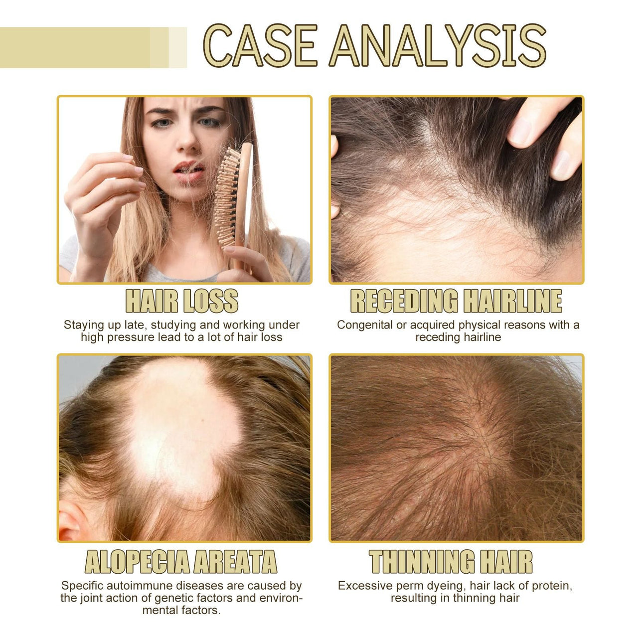 EELHOE Rosemary Essential Oil For Hair Care, Gentle And Nourishing Hair Care Oil