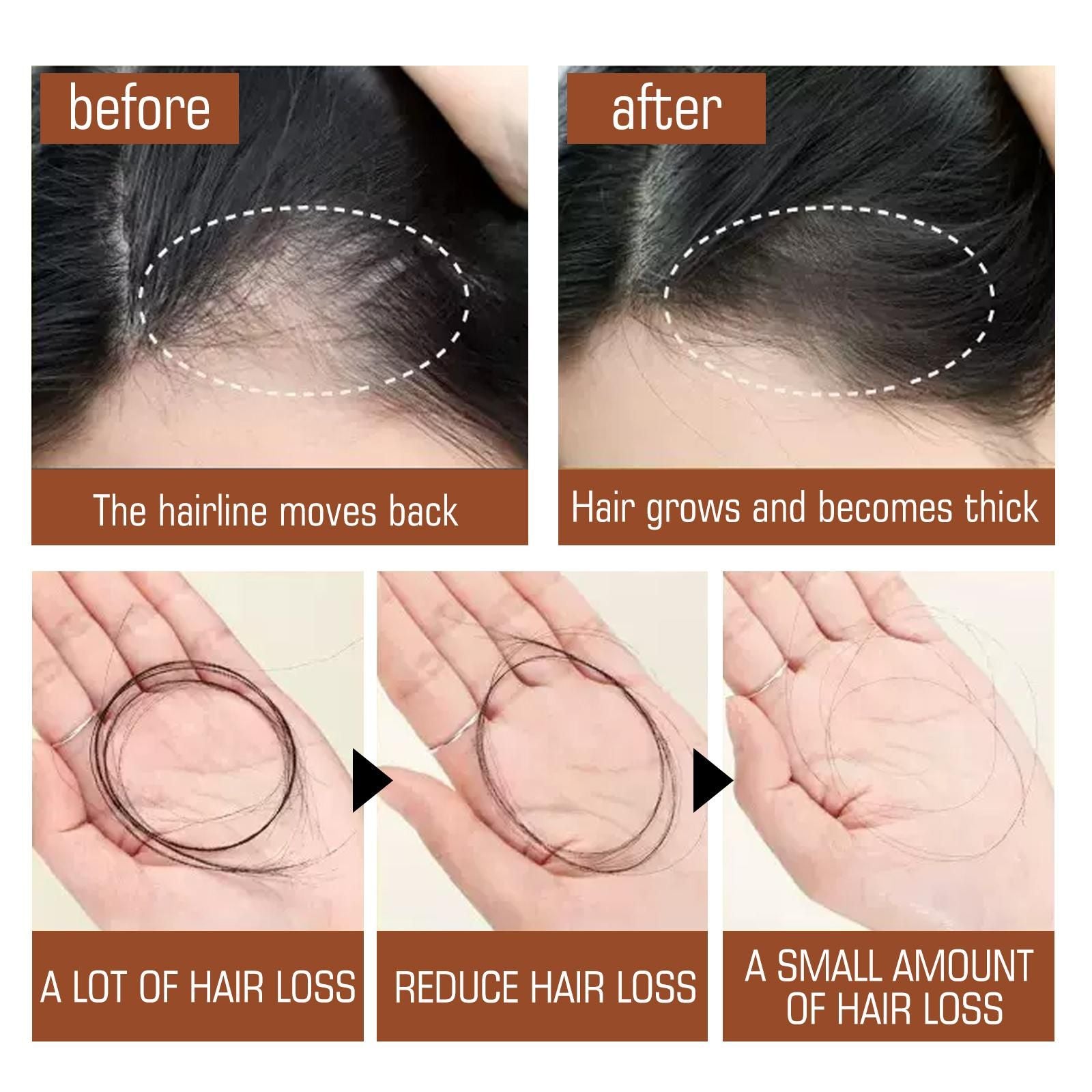 Batana Oil From Honduras - Get Fuller, Thicker, Healthier Hair - Great Gifts For Women Men Conditioner Haircare Silky - Hair Nutrition